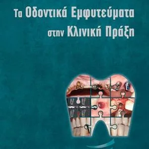 ΤΑ ΟΔΟΝΤΙΚΑ ΕΜΦΥΤΕΥΜΑΤΑ ΣΤΗΝ ΚΛΙΝΙΚΗ ΠΡΑΞΗ